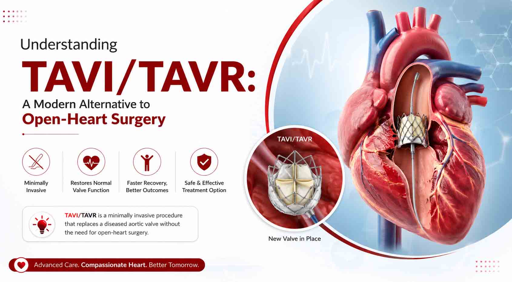 tavi-tavr-procedure